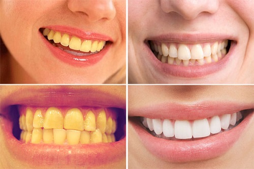 Nước súc miệng Crest 3D cho bạn hàm răng trắng sáng  nhanh chóng